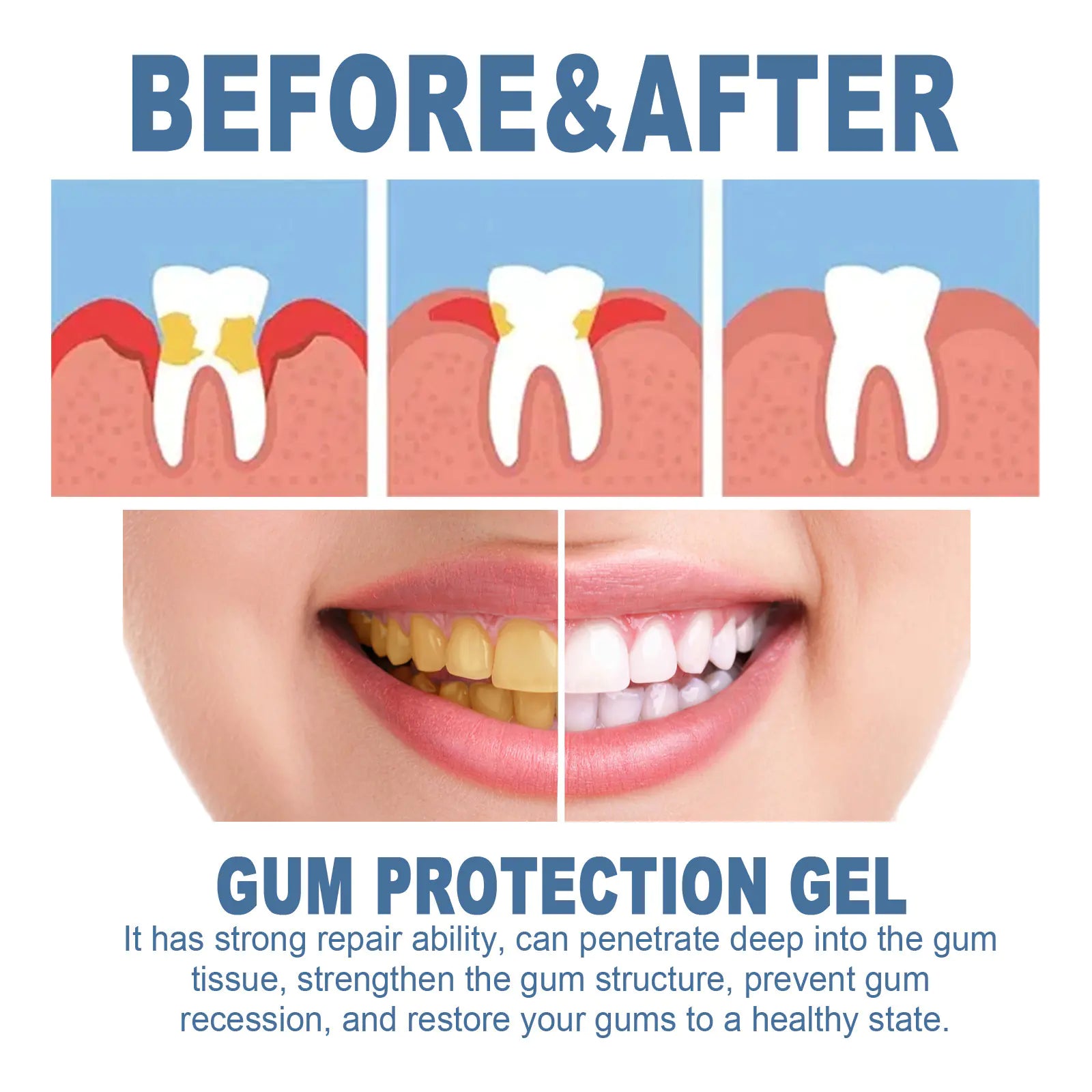 ORALHOE Tooth Repair Gel and Whitening Care Pen